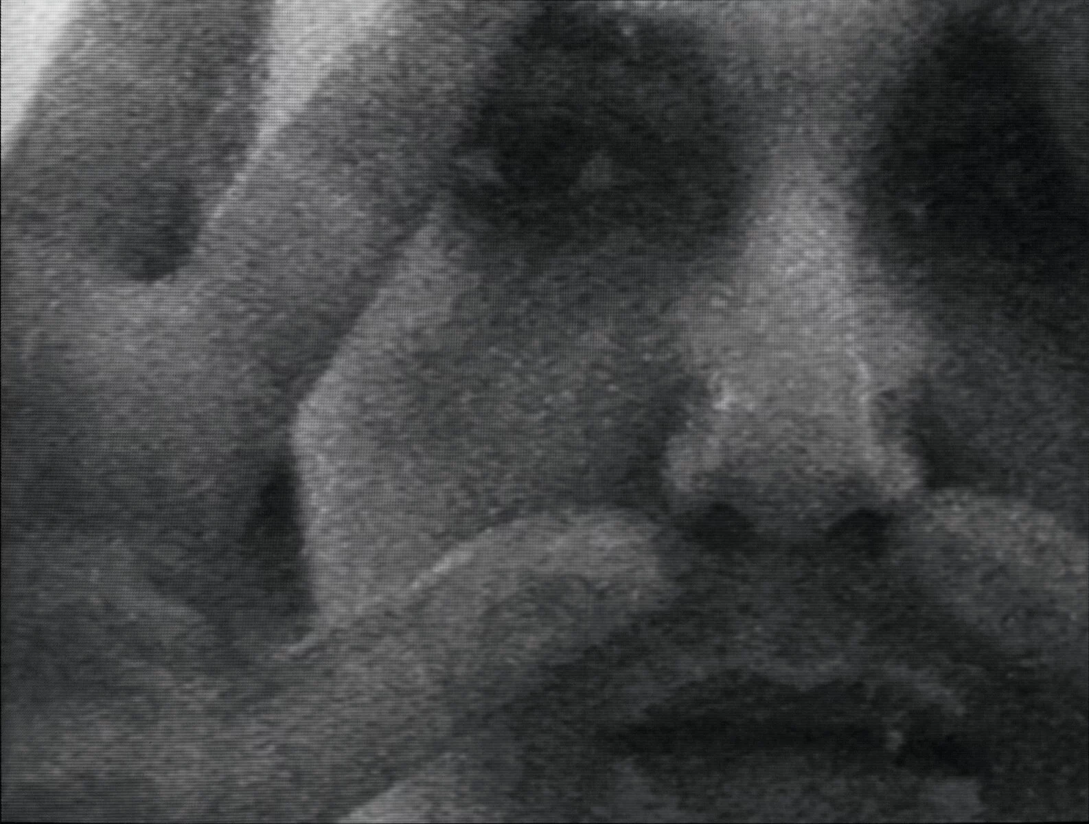 Still image from black and white video featuring a close up of a person's face. Their hands are pressed up against a clear barrier.