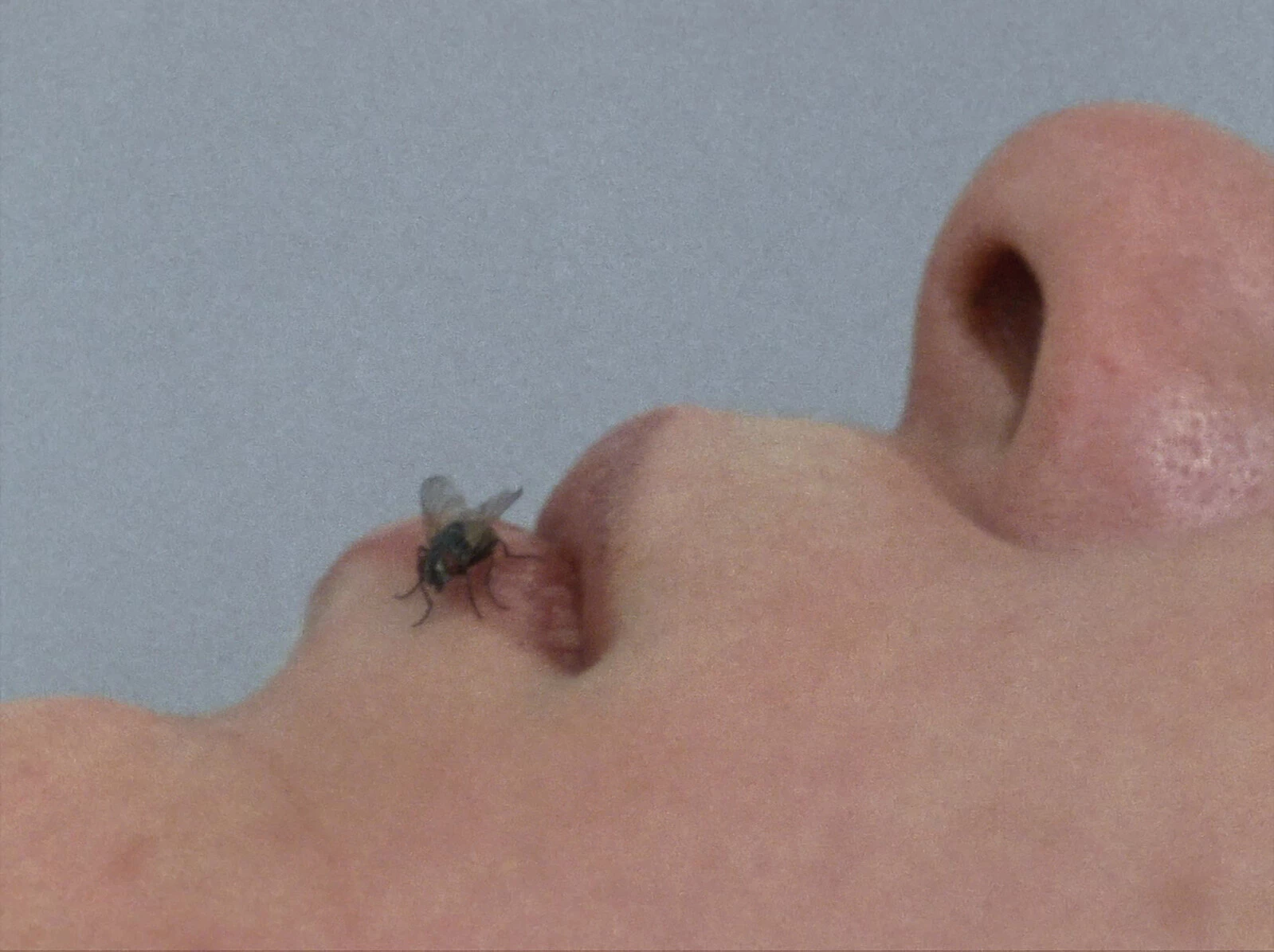 Close up of a person's lower face in a lying down position with a fly on their lower lip